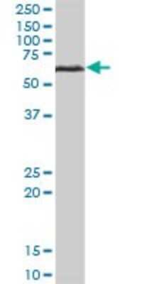 Western Blot: Beta Ig-h3/TGFBI Antibody [H00007045-B01P] - Analysis of TGFBI expression in human liver.