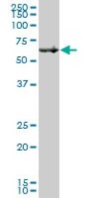 Western Blot: Beta Ig-h3/TGFBI Antibody [H00007045-B01P] - Analysis of TGFBI expression in human pancreas.
