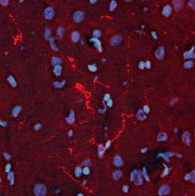 Immunohistochemistry: Beta-endorphin Antibody [NB120-10339] - Detection of beta-Endorphin in rat ventral lateral periaqueductal grey matter (PAG). Brain was fixed with 4% formaldehyde and cut into 10 um thick cryostat sections. Tissue was incubated with rabbit polyclonal antibody to beta-Endorphin at 10 ug/mL overnight at 4 degrees C followed by incubation with Donkey anti-rabbit Rhodamine Red conjugated secondary antibodies at 1:200. Tissue was counterstained with DAPI (blue color) to visualize cell nuclei.