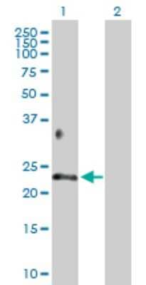 Western Blot: Betacellulin/BTC Antibody [H00000685-D01P] - Analysis of BTC expression in transfected 293T cell line by BTC polyclonal antibody.Lane 1: BTC transfected lysate(19.70 KDa).Lane 2: Non-transfected lysate.