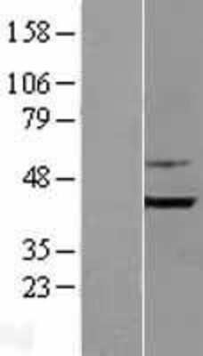 Western Blot: Bi-f-1/Endophilin-B1 Overexpression Lysate (Adult Normal) [NBL1-15933] Left-Empty vector transfected control cell lysate (HEK293 cell lysate); Right -Over-expression Lysate for Bi-f-1/Endophilin-B1.