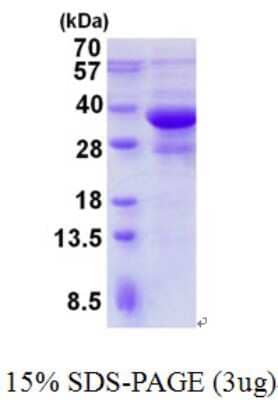 SDS-Page: Bi-f-1/Endophilin-B1 Protein [NBP2-23467]