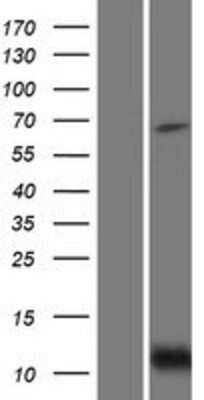 Western Blot: Bid Overexpression Lysate (Adult Normal) [NBP2-04747] Left-Empty vector transfected control cell lysate (HEK293 cell lysate); Right -Over-expression Lysate for Bid.