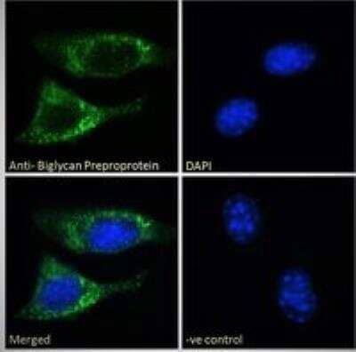 Immunocytochemistry/Immunofluorescence: Biglycan Antibody [NB100-55407] - Analysis of paraformaldehyde fixed NIH3T3 cells, permeabilized with 0.15% Triton. Primary incubation 1hr (10 ug/mL) followed by Alexa Fluor 488 secondary antibody (2 ug/mL), showing Golgi staining. The nuclear stain is DAPI (blue). Negative control: Unimmunized goat IgG (10 ug/mL) followed by Alexa Fluor 488 secondary antibody (2 ug/mL).