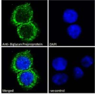 Immunocytochemistry/Immunofluorescence: Biglycan Antibody [NB100-55407] - Analysis of paraformaldehyde fixed HepG2 cells, permeabilized with 0.15% Triton. Primary incubation 1hr (10 ug/mL) followed by Alexa Fluor 488 secondary antibody (2 ug/mL), showing Golgi/ER staining. The nuclear stain is DAPI (blue). Negative control: Unimmunized goat IgG (10 ug/mL) followed by Alexa Fluor 488 secondary antibody (2 ug/mL).