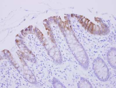 Immunohistochemistry-Paraffin: Biglycan Antibody [NBP1-32371] - Paraffin-embedded Colon Epithelium; antibody dilution 1:250.