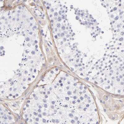 Immunohistochemistry-Paraffin: Biglycan Antibody [NBP1-84971] - Staining of human testis shows weak to moderate cytoplasmic positivity in peritubular myoid cells.