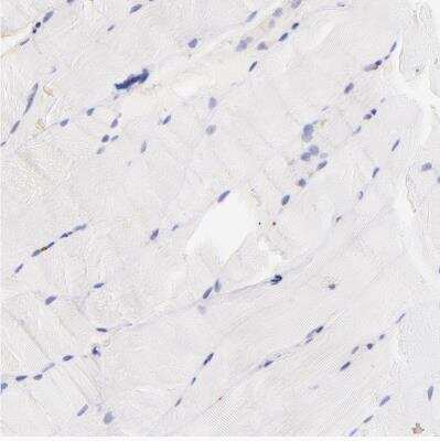 Immunohistochemistry-Paraffin: Biglycan Antibody [NBP1-84971] - Staining of human skeletal muscle shows no positivity in myocytes as expected.