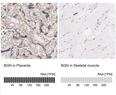 Immunohistochemistry-Paraffin: Biglycan Antibody [NBP1-84971] - Analysis in human placenta and skeletal muscle tissues.  Corresponding BGN RNA-seq data are presented for the same tissues.