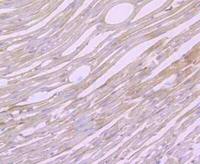 Immunohistochemistry-Paraffin: Biglycan Antibody (JB71-31) [NBP2-75419] - Analysis of paraffin-embedded mouse heart tissue using anti-Biglycan antibody. Counter stained with hematoxylin.