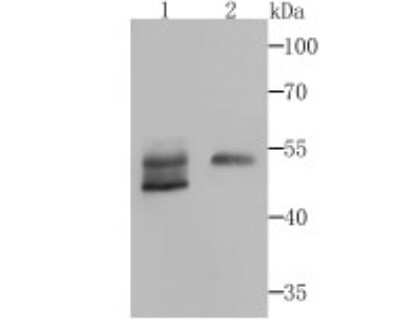 Western Blot: Biglycan Antibody (JB71-31) [NBP2-75419] - Analysis of Biglycan on mouse heart and human skin tissue lysates using anti-Biglycan antibody at 1/500 dilution.