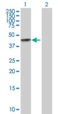 Western Blot: Biglycan Antibody [H00000633-D01P] - Analysis of BGN expression in transfected 293T cell line by BGN polyclonal antibody.Lane 1: BGN transfected lysate(41.70 KDa).Lane 2: Non-transfected lysate.
