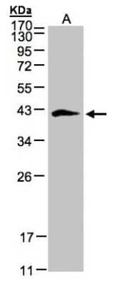 Western Blot: Biglycan Antibody [NBP1-32371] - Sample(30 ug whole cell lysate)A:293T12% SDS PAGE, antibody diluted at 1:500.