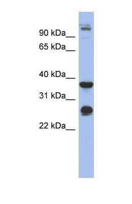 Western Blot: Biglycan Antibody [NBP1-57933] - Human Fetal Heart tissue lysate at a concentration of 1ug/ml.