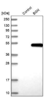 Western Blot: Biglycan Antibody [NBP1-84971] - Analysis in control (vector only transfected HEK293T lysate) and BGN over-expression lysate (Co-expressed with a C-terminal myc-DDK tag (3.1 kDa) in mammalian HEK293T cells).