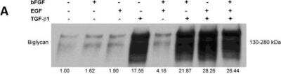 <b>Biological Strategies Validation and Orthogonal Strategies Validation.</b>Western Blot: Biglycan Antibody [NBP1-84971] - Treatment of CAFs with combined cytokines or cancer cell-derived secretomes affects ECM protein expression. Western blot showing the effects of bFGF, EGF and TGF beta 1 treatment (10 ng/ml) on the expression of biglycan in CAFs. Image collected and cropped by CiteAb from the following publication (//pubmed.ncbi.nlm.nih.gov/25593993/) licensed under a CC-BY license.