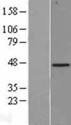 Western Blot: Biglycan Overexpression Lysate (Adult Normal) [NBL1-07973] Left-Empty vector transfected control cell lysate (HEK293 cell lysate); Right -Over-expression Lysate for Biglycan.