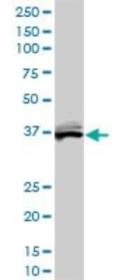 Western Blot: Biliverdin Reductase A/BLVRA Antibody (4G4-2B6) [H00000644-M01] - BLVRA monoclonal antibody (M01), clone 4G4-2B6. Analysis of BLVRA expression in HeLa.