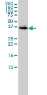 Western Blot: Biliverdin Reductase A/BLVRA Antibody (4G4-2B6) [H00000644-M01] - BLVRA monoclonal antibody (M01), clone 4G4-2B6 Analysis of BLVRA expression in 293.