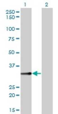 Western Blot: Biliverdin Reductase A/BLVRA Antibody (4G4-2B6) [H00000644-M01] - Analysis of BLVRA expression in transfected 293T cell line by BLVRA monoclonal antibody (M01), clone 4G4-2B6.Lane 1: BLVRA transfected lysate(33.4 KDa).Lane 2: Non-transfected lysate.