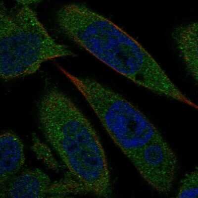 Immunocytochemistry/Immunofluorescence: Biliverdin Reductase A/BLVRA Antibody [NBP2-58063] - Staining of human cell line PC-3 shows localization to cytosol.