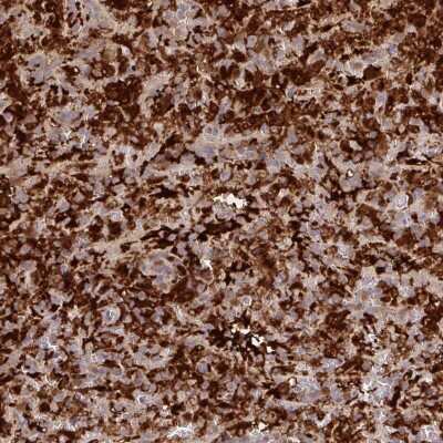 Immunohistochemistry: Biliverdin Reductase A/BLVRA Antibody [NBP2-38725] - Staining of human spleen shows strong cytoplasmic positivity in cells in red pulp.