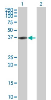 Western Blot: Biliverdin Reductase A/BLVRA Antibody [H00000644-D01P] - Analysis of BLVRA expression in transfected 293T cell line by BLVRA polyclonal antibody.Lane 1: BLVRA transfected lysate(33.40 KDa).Lane 2: Non-transfected lysate.
