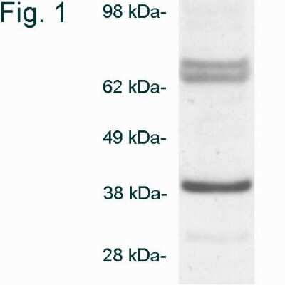 Western Blot: Biliverdin Reductase A/BLVRA Antibody [NB120-3466] - Analysis of BLVRA on HeLa cell extract.