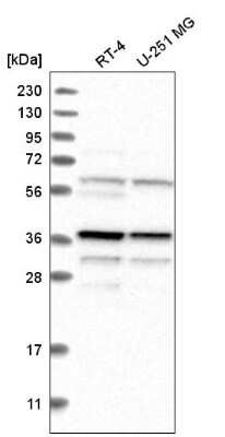 Western Blot Biliverdin Reductase A/BLVRA Antibody