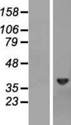 Western Blot Biliverdin Reductase A/BLVRA Overexpression Lysate