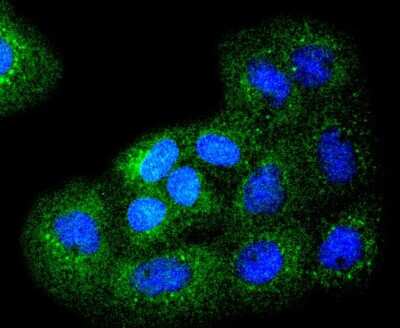 Immunocytochemistry/Immunofluorescence: Bim Antibody (SU0318) [NBP2-67456] - Staining Bim in A431 cells (green). The nuclear counter stain is DAPI (blue). Cells were fixed in paraformaldehyde, permeabilised with 0.25% Triton X100/PBS.