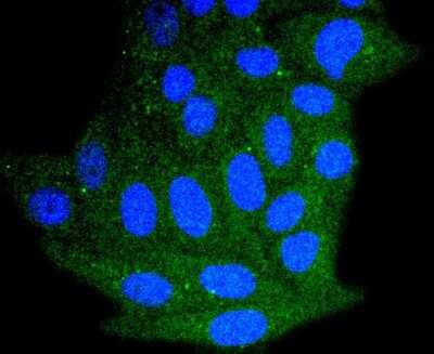 Immunocytochemistry/Immunofluorescence: Bim Antibody (SU0318) [NBP2-67456] - Staining Bim in HepG2 cells (green). The nuclear counter stain is DAPI (blue). Cells were fixed in paraformaldehyde, permeabilised with 0.25% Triton X100/PBS.