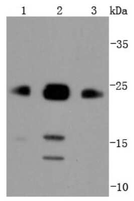 Western Blot: Bim Antibody (SU0318) [NBP2-67456] - Analysis of Bim on different lysates using anti-Bim antibody at 1/1,000 dilution. Positive control: Lane 1: Raji Lane 2: Jurkat Lane 3: A431