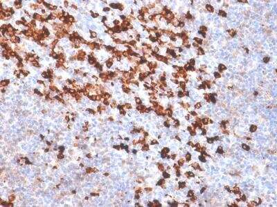 Immunohistochemistry-Paraffin: Biotin (Vitamin B7 or Vitamin H) Antibody (BTN/2032R) - Azide and BSA Free [NBP2-61393] - Formalin-paraffin Tonsil stained with biotinylated Kappa Light Chain probe followed by anti-biotin Recombinant Rabbit Monoclonal antibody (BTN/2032R