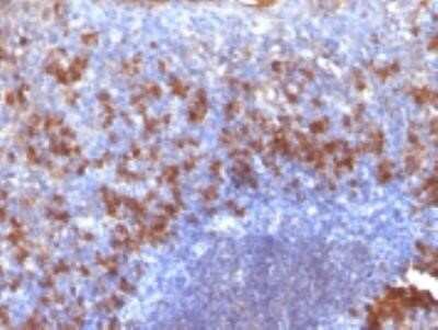 Immunohistochemistry-Paraffin: Biotin (Vitamin B7 or Vitamin H) Antibody (SPM375) - Azide and BSA Free [NBP2-34771] - Formalin-fixed, paraffin-embedded human Tonsil stained with biotinylated Lambda Light Chain probe followed by anti-biotin Monoclonal Antibody (SPM375).