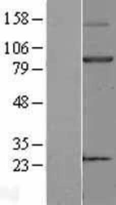 Western Blot: Blood Group Kell Antigen Overexpression Lysate (Adult Normal) [NBL1-12227] Left-Empty vector transfected control cell lysate (HEK293 cell lysate); Right -Over-expression Lysate for Blood Group Kell Antigen.