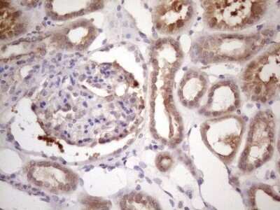 Immunohistochemistry: Bmf Antibody (OTI6F3) - Azide and BSA Free [NBP2-72311] - Analysis of Human Kidney tissue. (Heat-induced epitope retrieval by 1 mM EDTA in 10mM Tris, pH8.5, 120C for 3min)