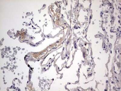 Immunohistochemistry: Boll Antibody (OTI2D11) - Azide and BSA Free [NBP2-72180] - Analysis of Human lung tissue. (Heat-induced epitope retrieval by 1 mM EDTA in 10mM Tris, pH8.5, 120C for 3min)