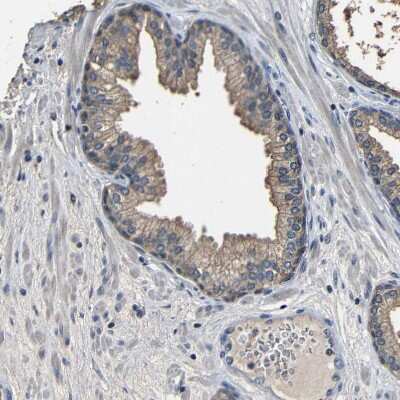 Immunohistochemistry-Paraffin: Bombesin Receptor Activated Protein Antibody [NBP1-93921] - Staining of human prostate shows weak cytoplasmic positivity in glandular cells.
