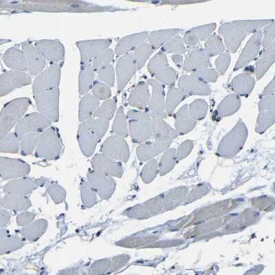 Immunohistochemistry-Paraffin: Bombesin Receptor Activated Protein Antibody [NBP1-93921] - Staining of human skeletal muscle shows no positivity in myocytes as expected.