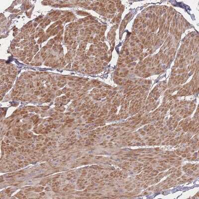 Immunohistochemistry-Paraffin: Bone marrow stromal cell antigen 1 Antibody [NBP2-14363] Staining of human smooth muscle shows moderate cytoplasmic positivity in smooth muscle cells.