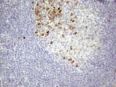 Immunohistochemistry: Borealin Antibody (OTI4G3) - Azide and BSA Free [NBP2-71988] - Analysis of Human tonsil tissue. (Heat-induced epitope retrieval by 1mM EDTA in 10mM Tris buffer (pH8.5) at 120C for 3 min)