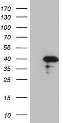 Western Blot: Borealin Antibody (OTI4G3) - Azide and BSA Free [NBP2-71988] - Analysis of HEK293T cells were transfected with the pCMV6-ENTRY control (Left lane) or pCMV6-ENTRY Borealin.