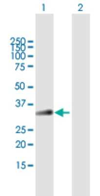 Western Blot: Bradykinin RB1/BDKRB1 Antibody [H00000623-B01P] - Analysis of BDKRB1 expression in transfected 293T cell line by BDKRB1 polyclonal antibody.  Lane 1: BDKRB1 transfected lysate(38.94 KDa). Lane 2: Non-transfected lysate.