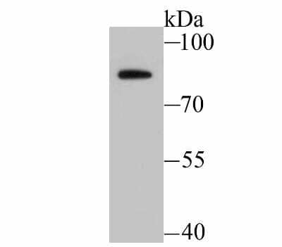 Western Blot: Bradykinin RB2/BDKRB2 Antibody (JU39-04) [NBP2-75421] - Analysis of BDKRB2 on MCF-7 cell lysate using anti-BDKRB2 antibody at 1/500 dilution.