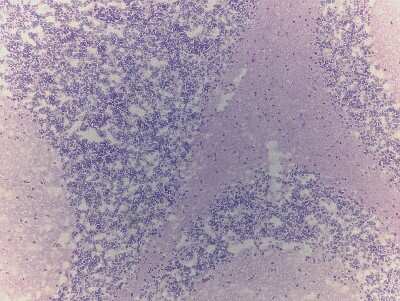 Hematoxylin & Eosin Stain: Brain Cerebellum Tissue Slides (Adult Normal) [NBP2-77520] - Human brain: Cerebellum, Normal