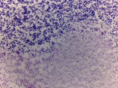 Hematoxylin & Eosin Stain: Brain Cerebellum Tissue Slides (Adult Normal Right) [NBP2-77522] - Human brain: right Cerebellum, Normal