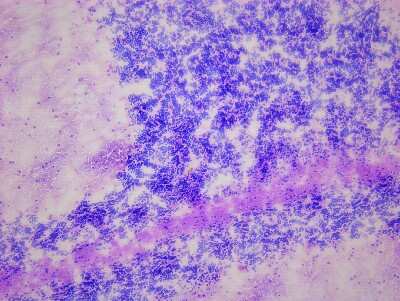 Hematoxylin & Eosin Stain: Brain Cerebellum Tissue Slides (Alzheimer's) [NBP2-77594] - Tissue: Human Brain (Cerebellum),  Pathology: Alzheimer's Disease