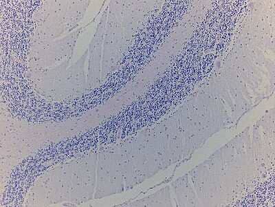 Hematoxylin & Eosin Stain: Brain Cerebellum Tissue Slides (Alzheimer's) [NBP2-77823] - Tissue: Human Brain (Cerebellum),  Pathology: Alzheimer's Disease