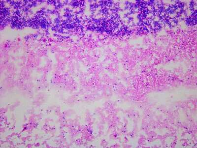 Hematoxylin & Eosin Stain: Brain Cerebellum Tissue Slides (Parkinson's) [NBP2-77691] - Tissue: Human Brain (Cerebellum),  Pathology: Parkinson's Disease